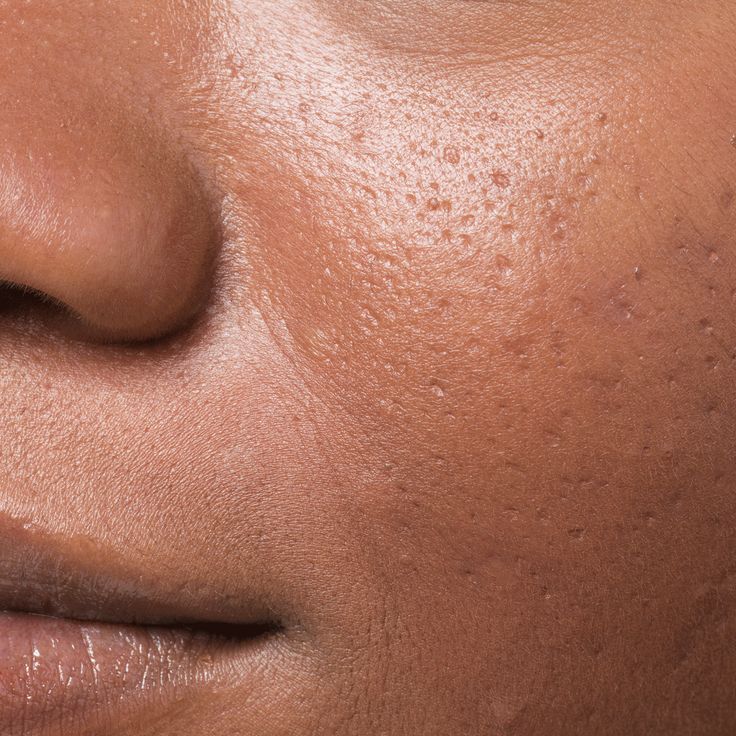 Order original Skin Concern Skincare Products in Nigeria | Acne, Dark Spots, Dry Skin | Rhema Beauty Shop in lagos Nigeria